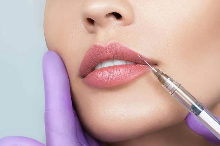 Avances en Aumento de Labios: La Innovación de IDentic Estética Lab en Málaga